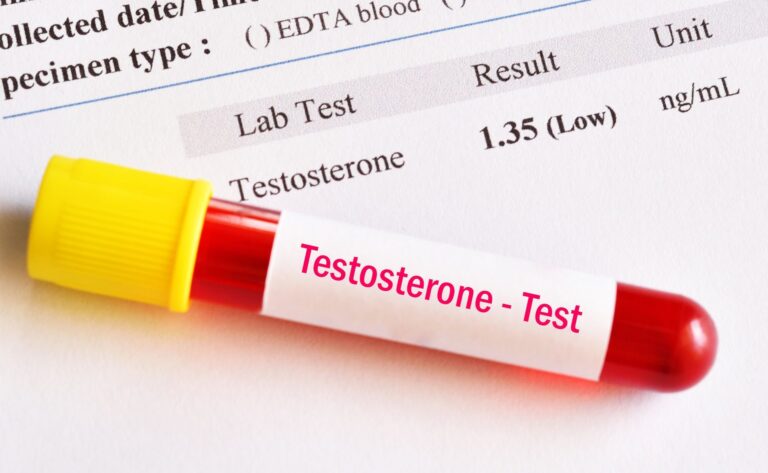 testosterone test results with blood sample illustrating alcohol effects on hormones